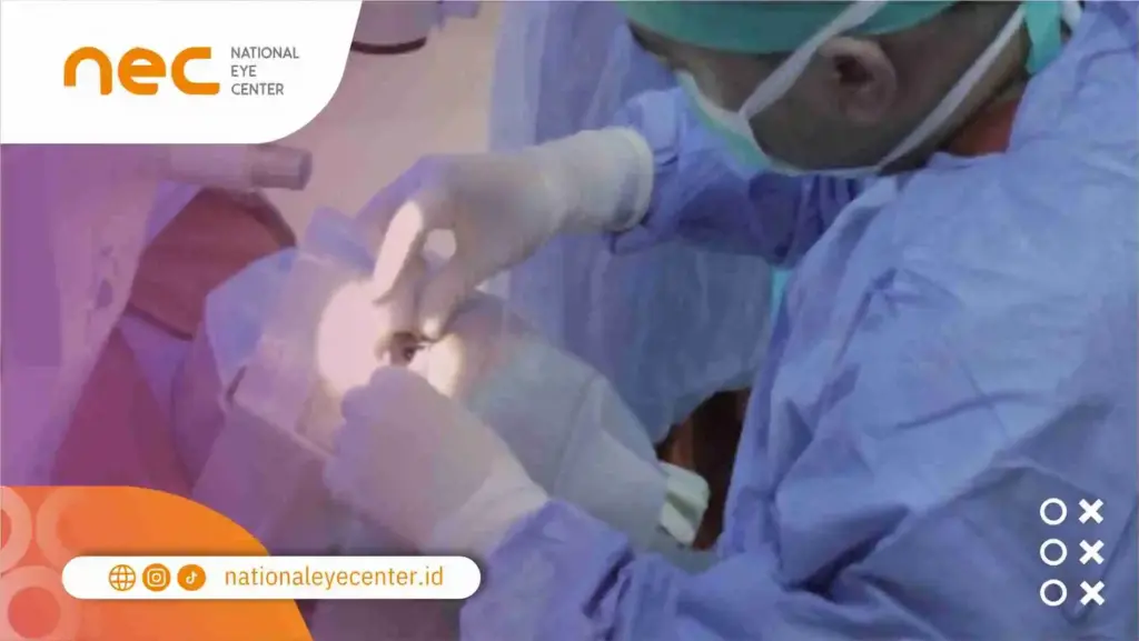 Operasi LASIK Mata Untuk Apa?