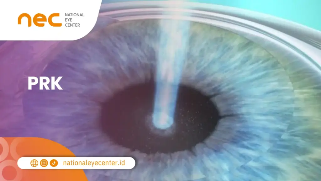 PRK