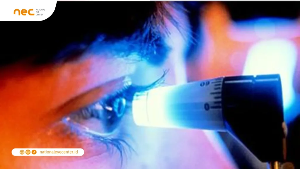 Kapan Tindakan Operasi untuk Glaukoma Kapan Tindakan Operasi untuk Glaukoma