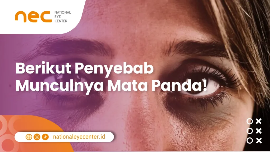 Penyebab Munculnya Mata Panda Penyebab Munculnya Mata Panda