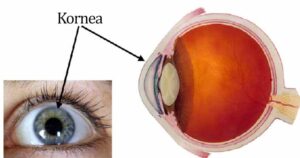 kornea - bagian mata