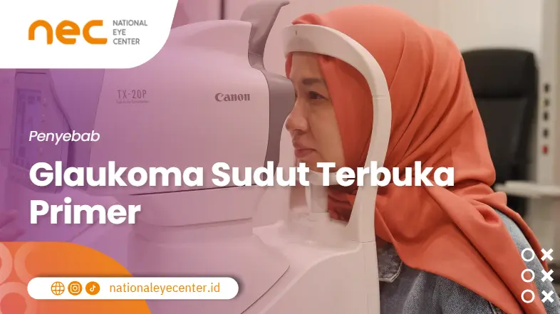 Penyebab Glaukoma Sudut Terbuka Primer