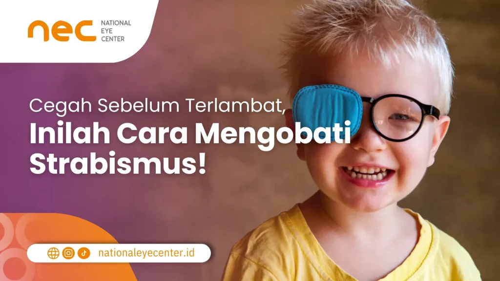 Cara Mengobati Strabismus