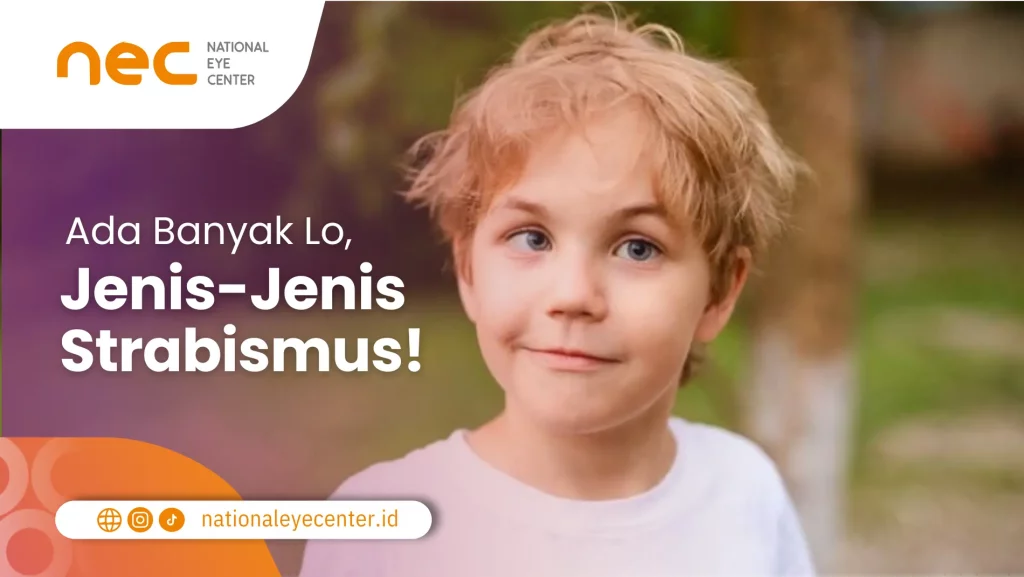 Jenis-Jenis Strabismus