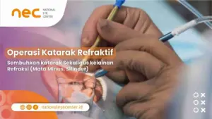 Operasi Katarak Refraktif: Sembuhkan katarak Sekaligus kelainan Refraksi (Mata Minus, Silinder)