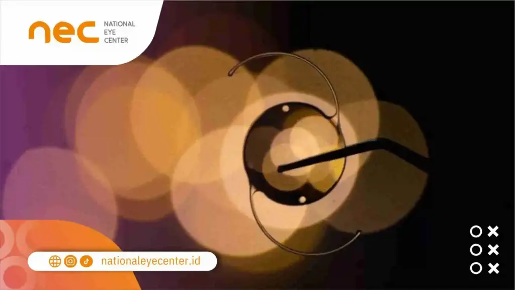 Kelebihan Operasi Katarak Refraktif