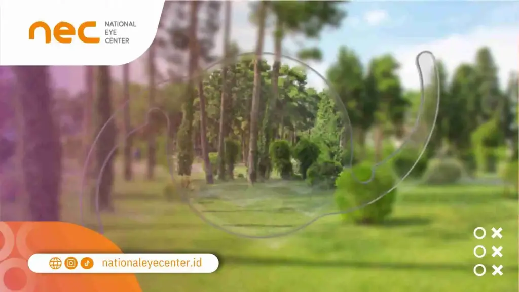 Apa Itu Operasi Katarak Refraktif?