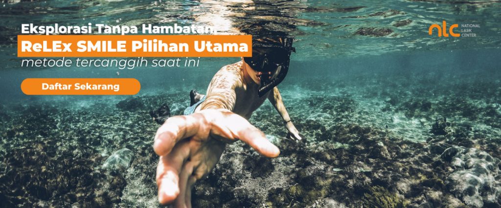 relex smile lasik surabaya