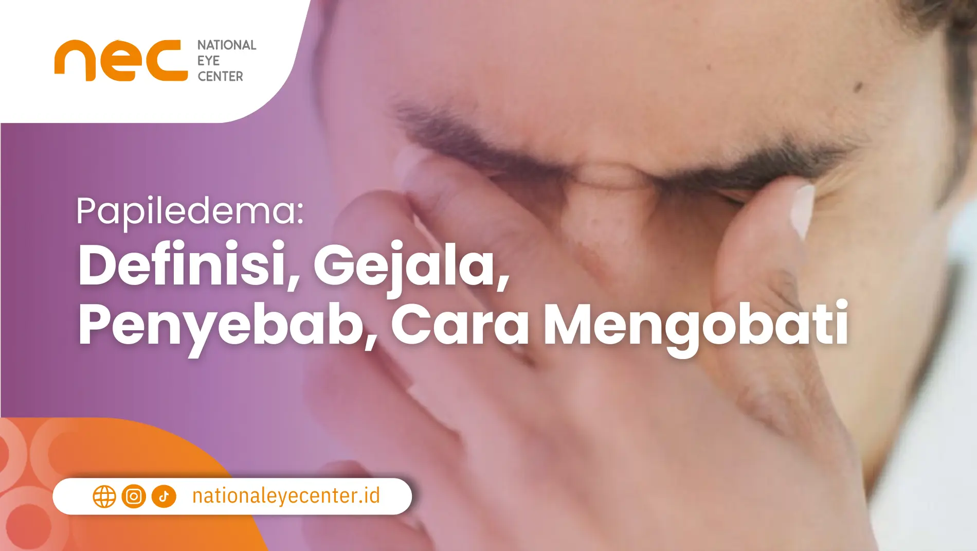 Papiledema Definisi, Gejala, Penyebab, Cara Mengobati