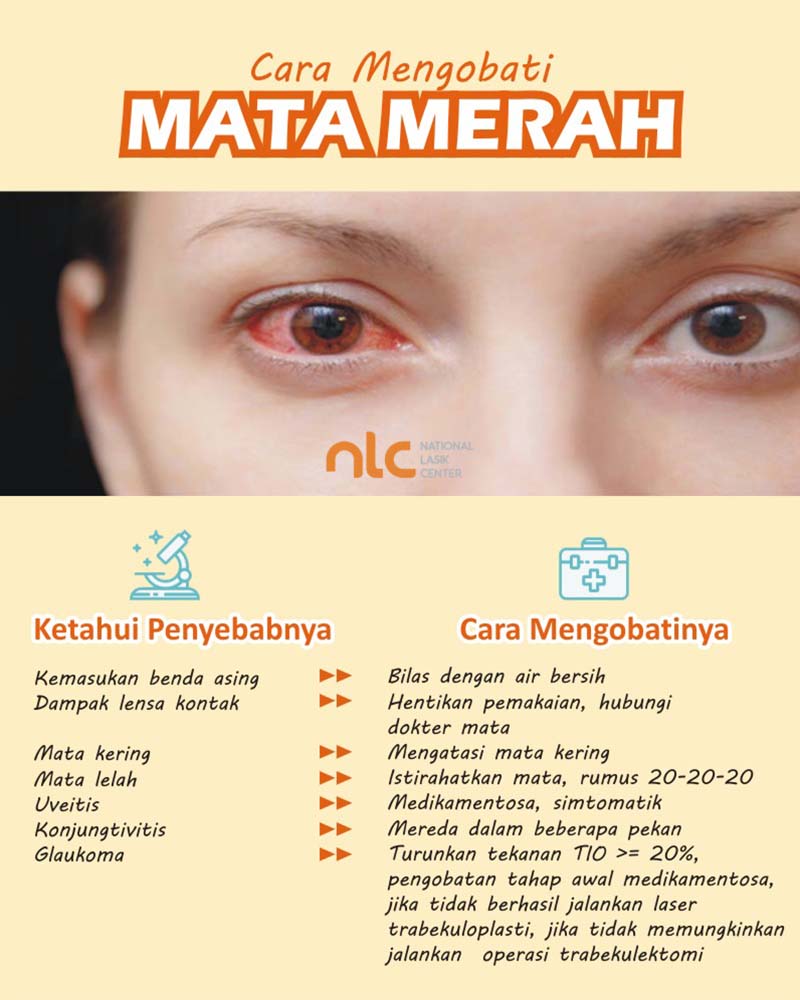 cara mengobati mata merah