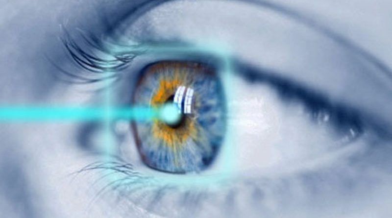 Perawatan Pasca Lasik