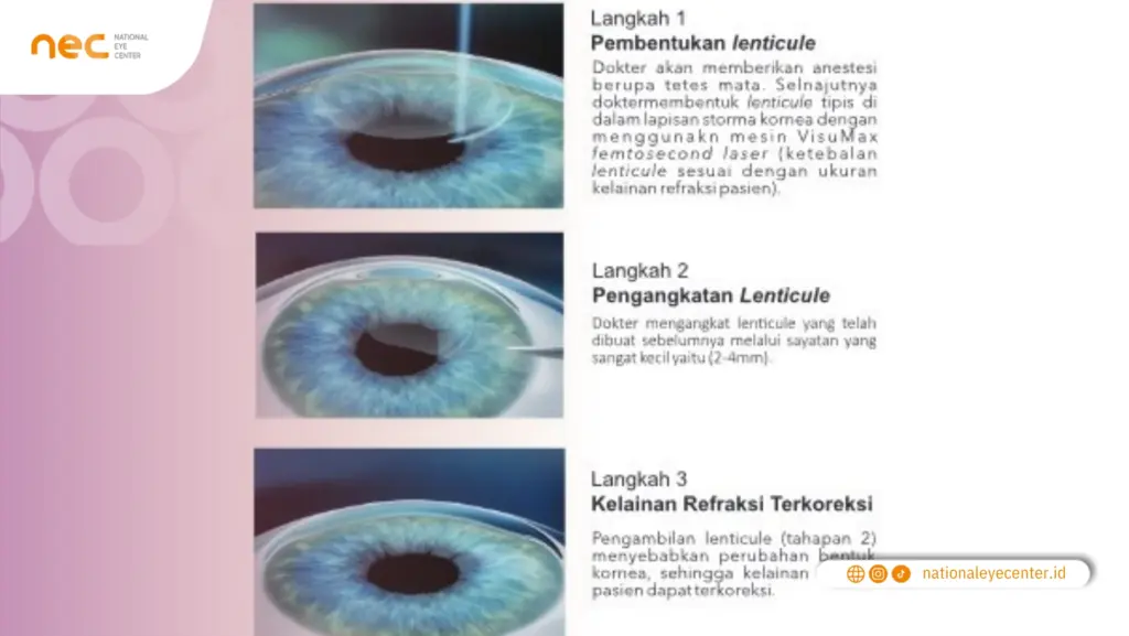 ZEISS Smile ZEISS Smile