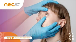 Pengobatan Blefarospasme