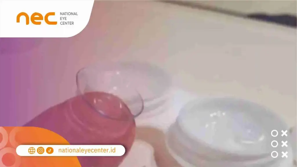 Penyebab Infeksi Karena Softlens 