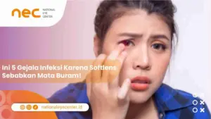 Ini 5 Gejala Infeksi Karena Softlens Sebabkan Mata Buram!