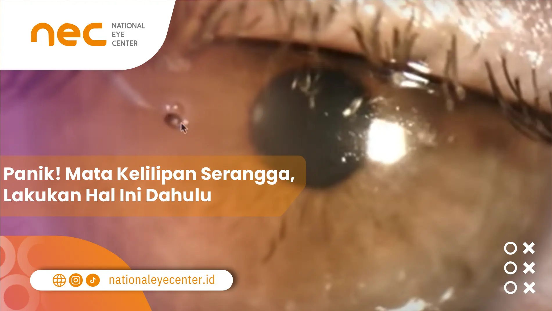 Panik! Mata Kelilipan Serangga, Lakukan Hal Ini Dahulu