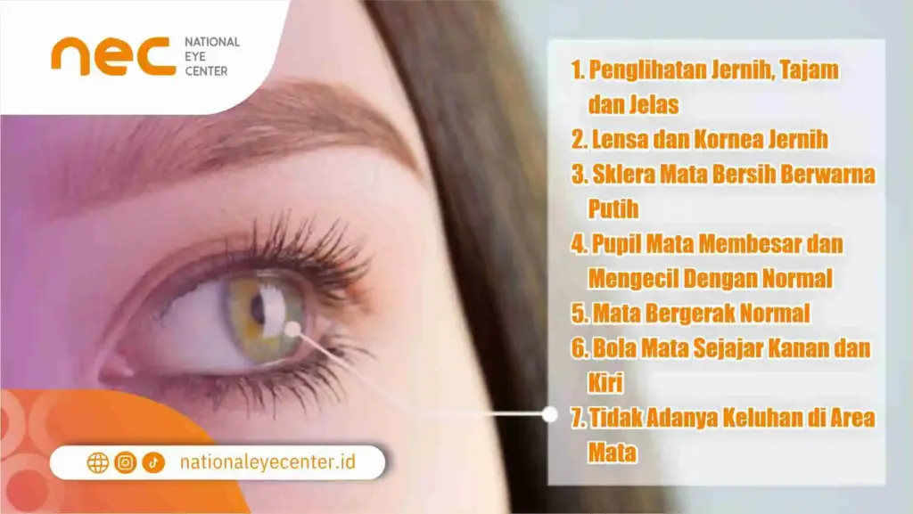 Ciri-Ciri Mata Sehat