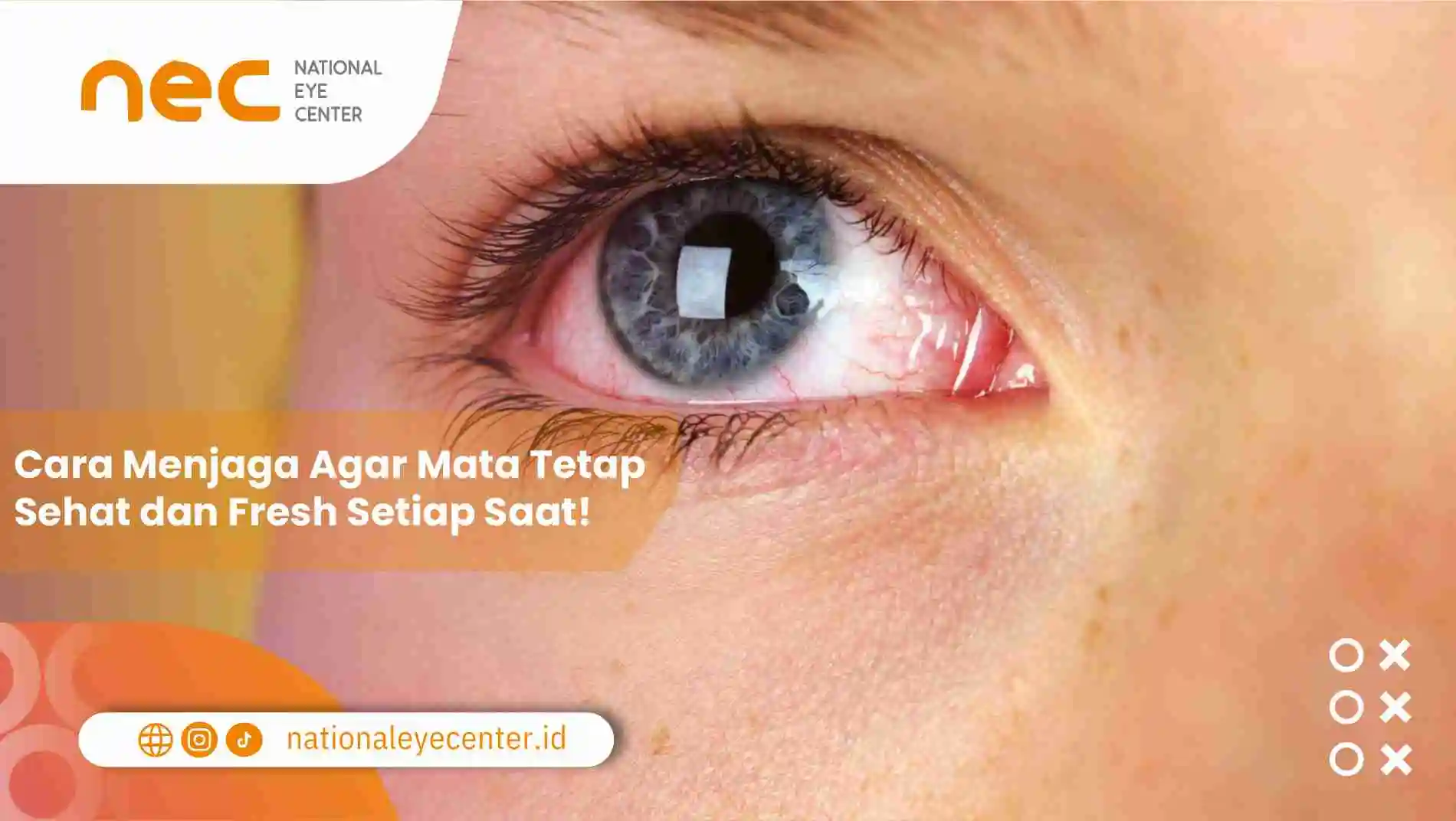 Cara Menjaga Agar Mata Tetap Sehat dan Fresh Setiap Saat!