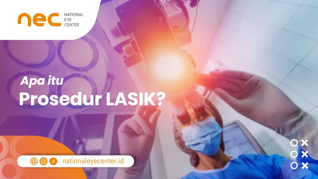 Apa Itu Prosedur Lasik Prosedur Lasik