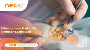 5 Keuntungan Phakic IOL: Tindakan Selain Lasik
