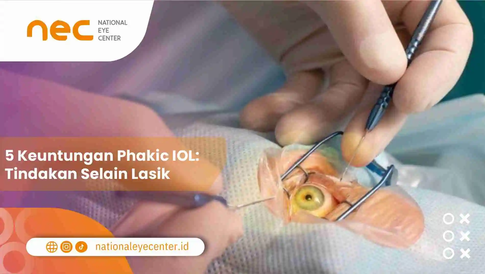 5 Keuntungan Phakic IOL: Tindakan Selain Lasik