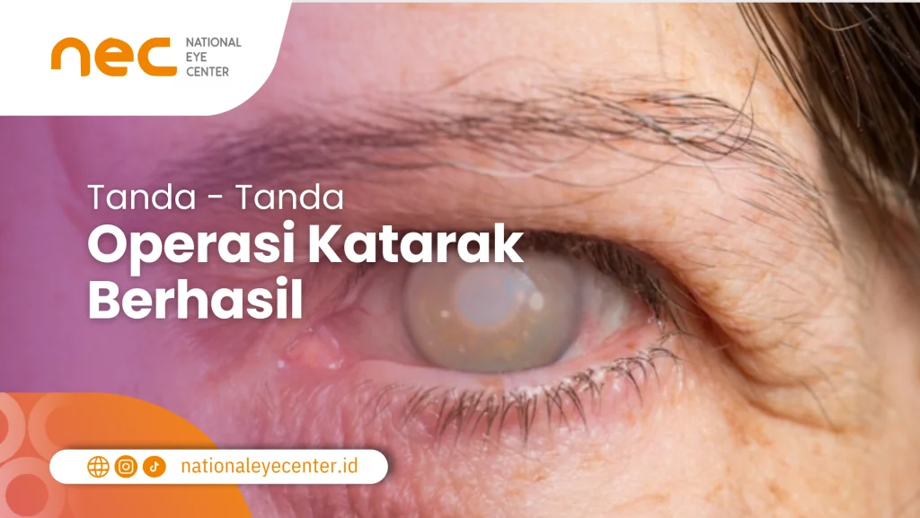 Tanda-Operasi-Katarak-Berhasil Tanda Operasi Katarak Berhasil