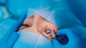 Contoh operasi Kantung Mata