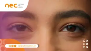 Pengobatan Mata Panda