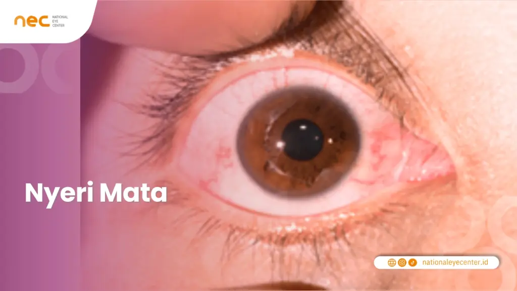 Nyeri mata