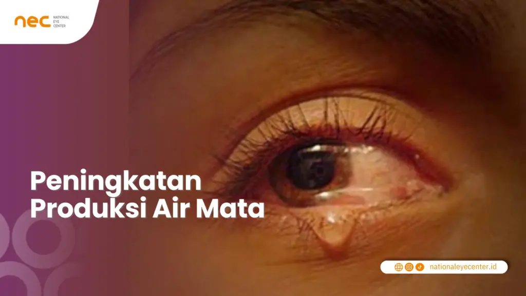 Peningkatan Produksi Air Mata