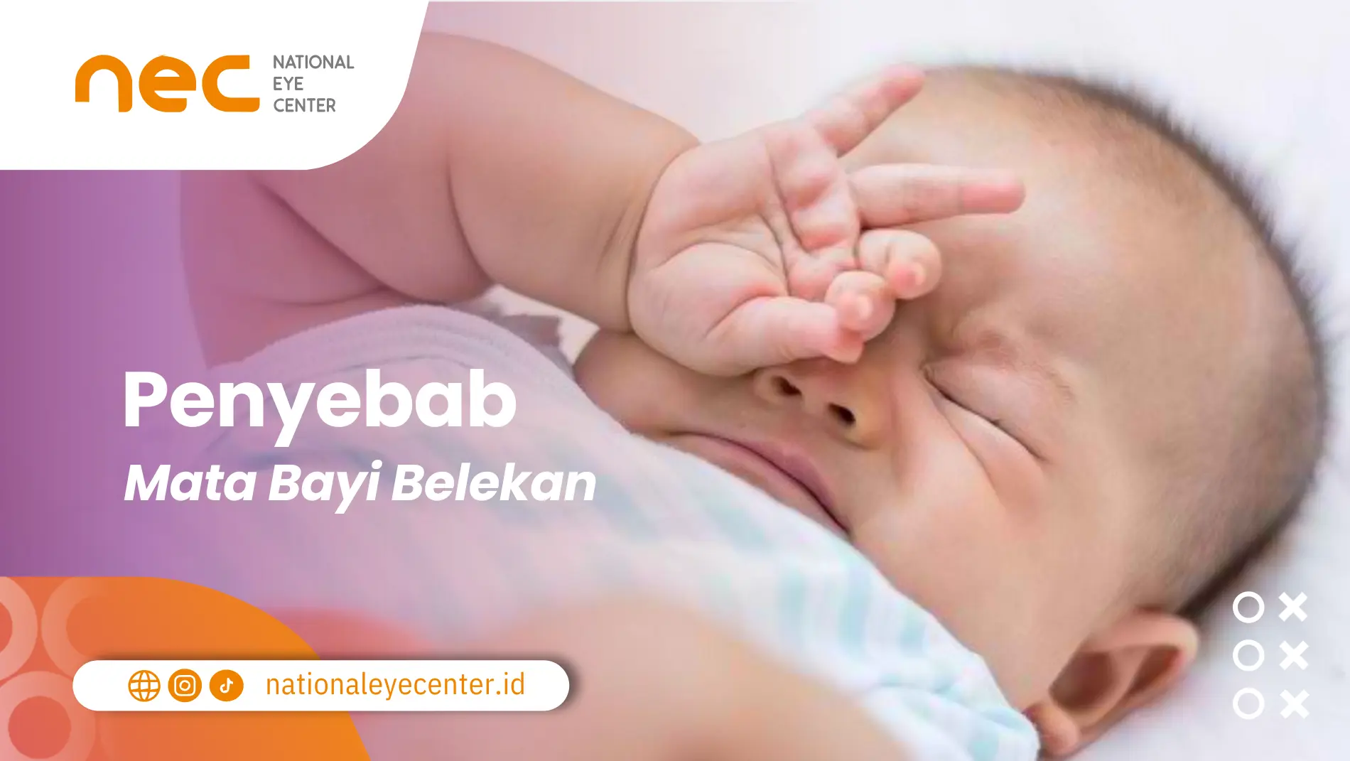 Penyebab Bayi Belekan