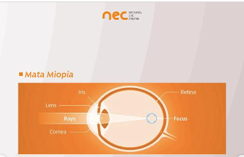 bentuk bola mata minus