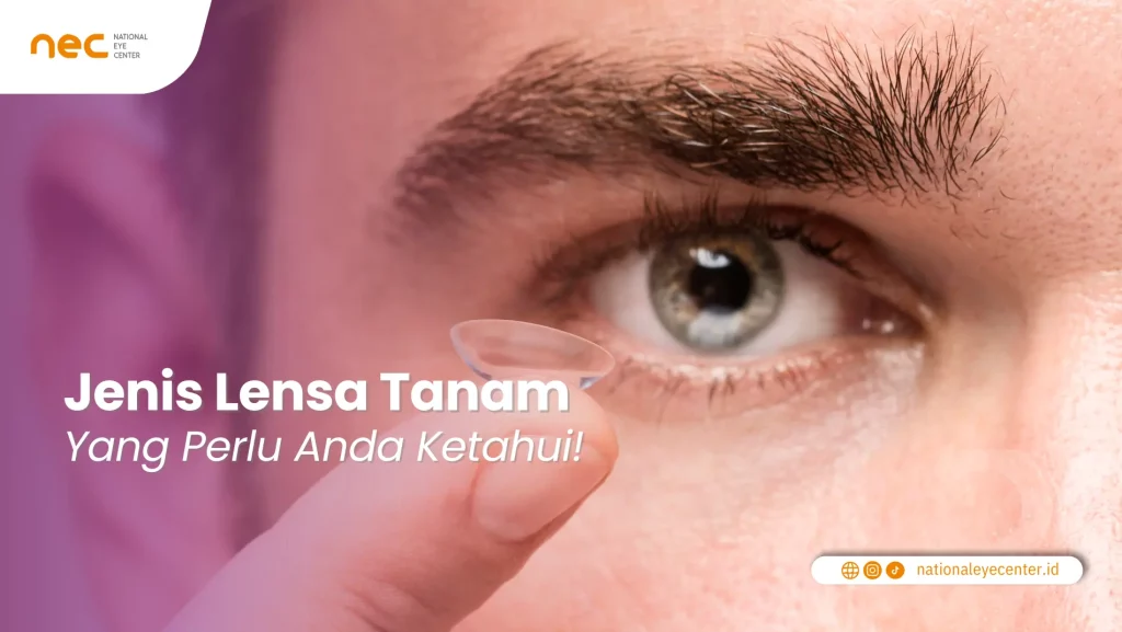 Jenis Lensa Tanam