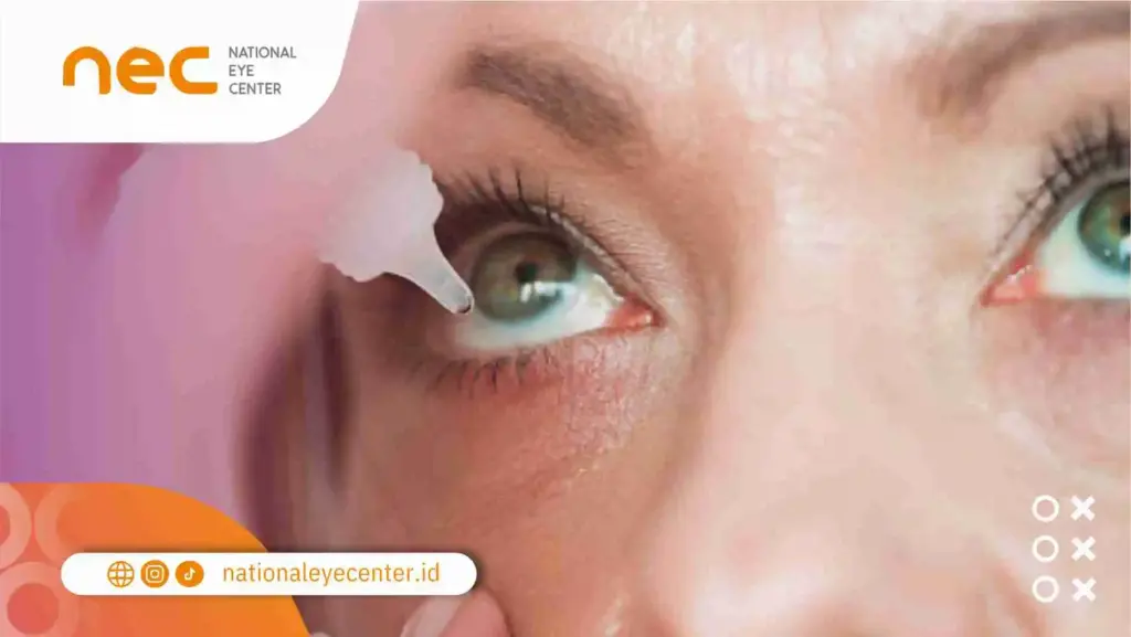 Cara Mengatasi Mata Perih Terkena Cabai