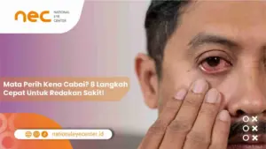 Mata Perih Kena Cabai? 8 Langkah Cepat Untuk Redakan Sakit!