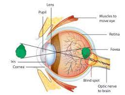 Contoh Gangguan saraf mata