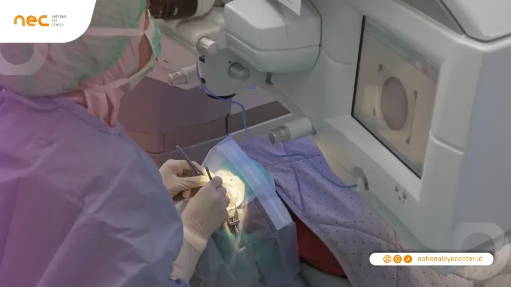 Kiesha Alvaro saat menjalankan prosedur LASIK ZEISS SMILE di NEC Surabaya Kiesha Alvaro saat menjalankan prosedur LASIK ZEISS SMILE di NEC Surabaya