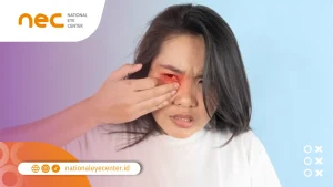 Penyebab Dakriosistitis