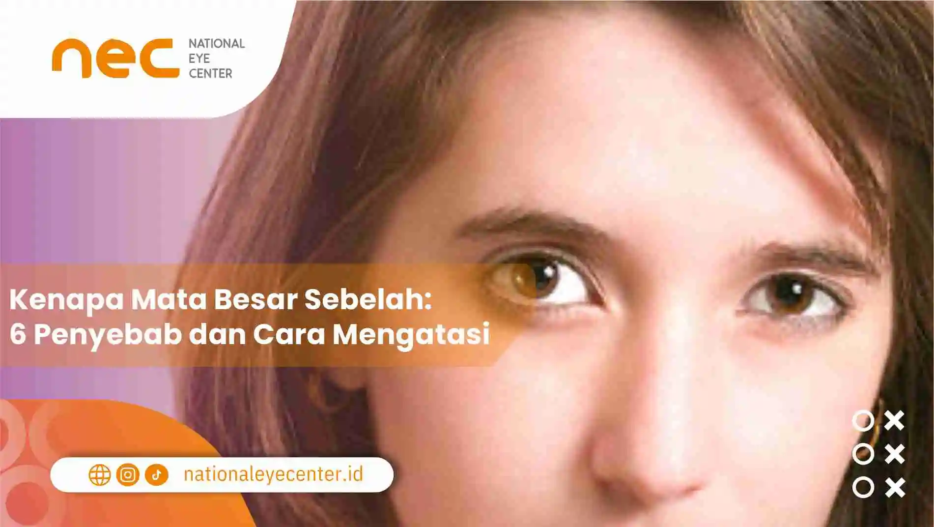 Kenapa Mata Besar Sebelah: 6 Penyebab dan Cara Mengatasi