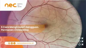 6 Cara Menghindari Gangguan Permanen Vitreoretina