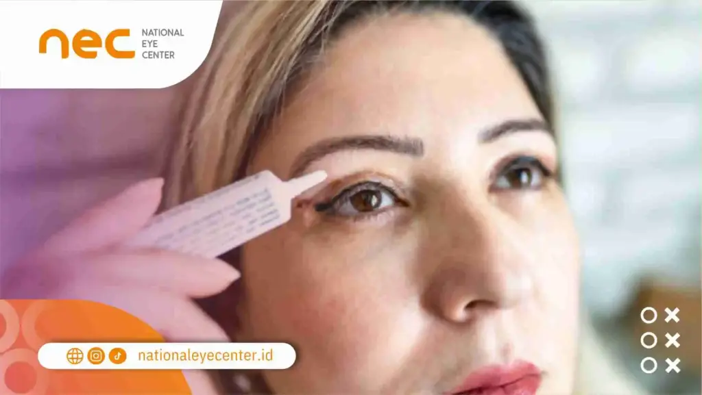 Cara Pengobatan Eksim Mata