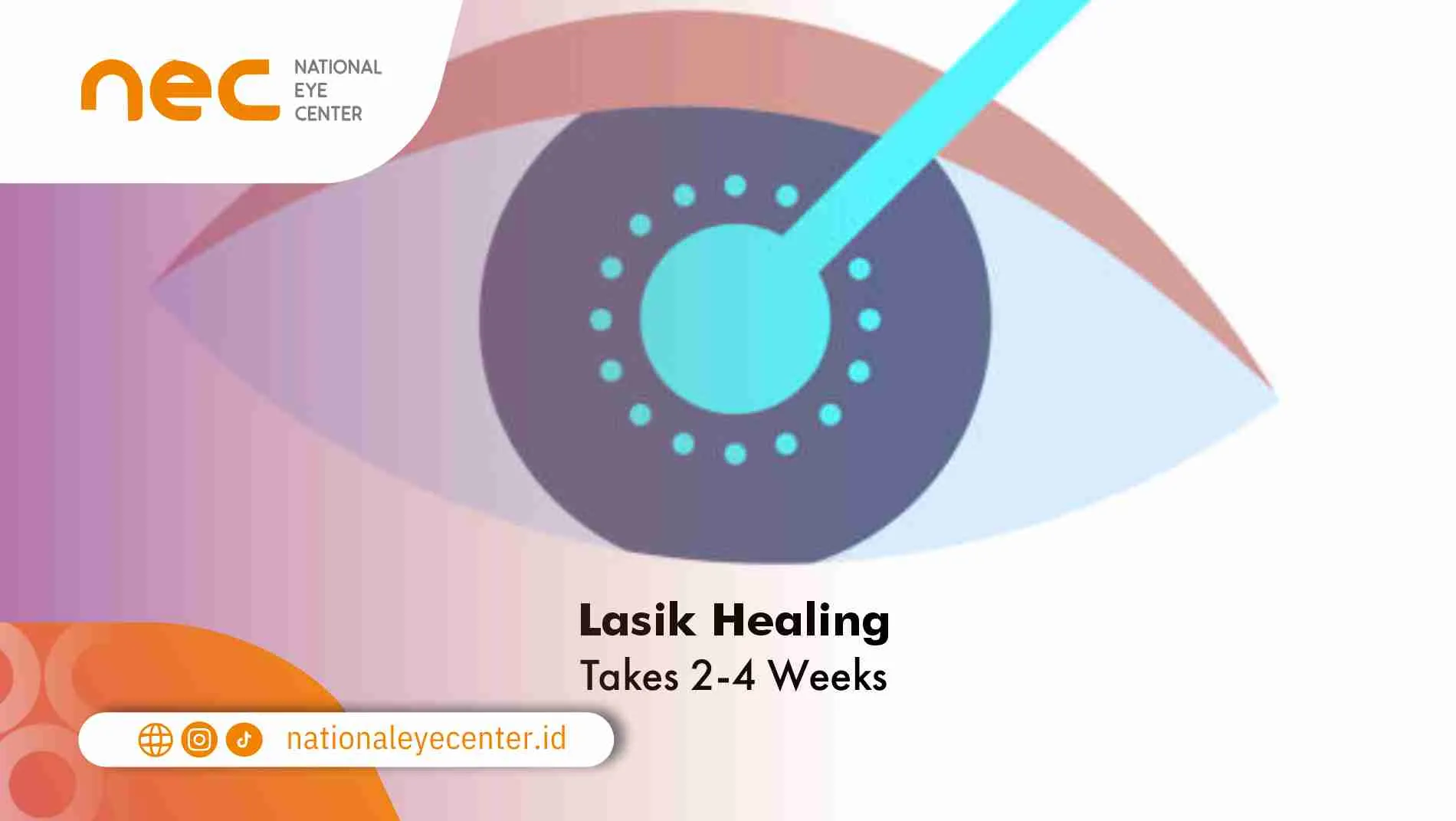 Lasik healing takes 2-4 weeks