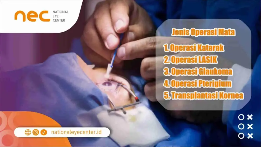 Jenis-jenis Operasi Mata