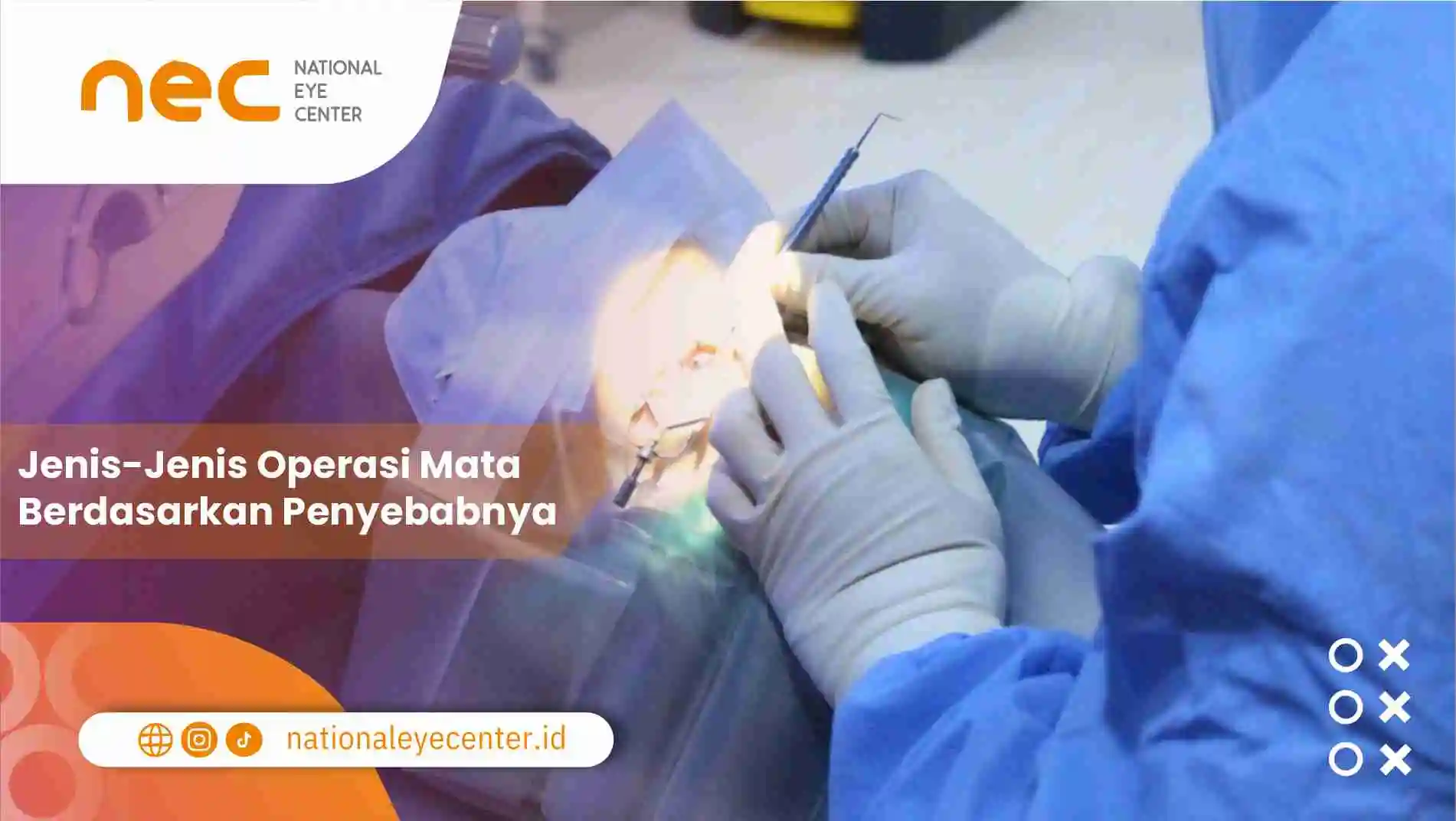 Jenis-Jenis Operasi Mata Berdasarkan Penyebabnya