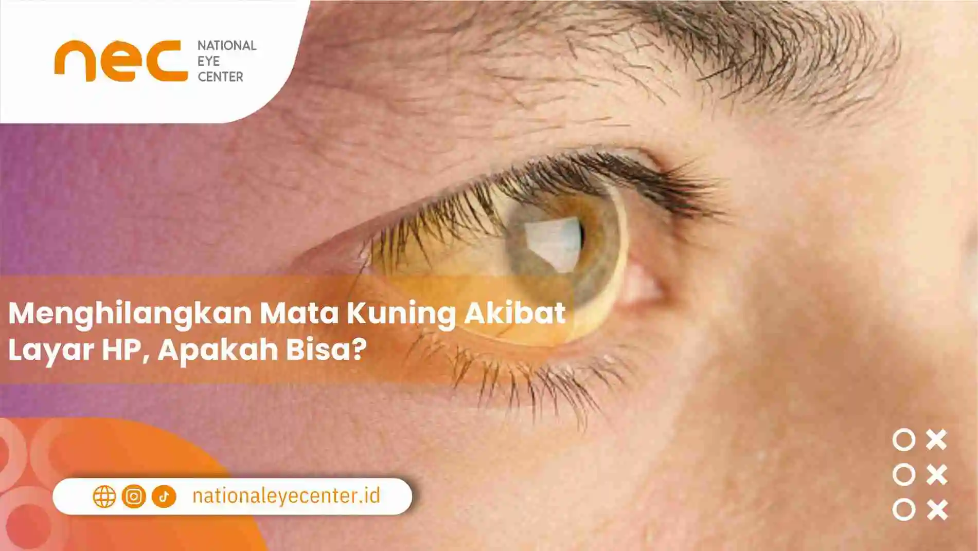 Menghilangkan Mata Kuning Akibat Layar HP, Apakah Bisa?