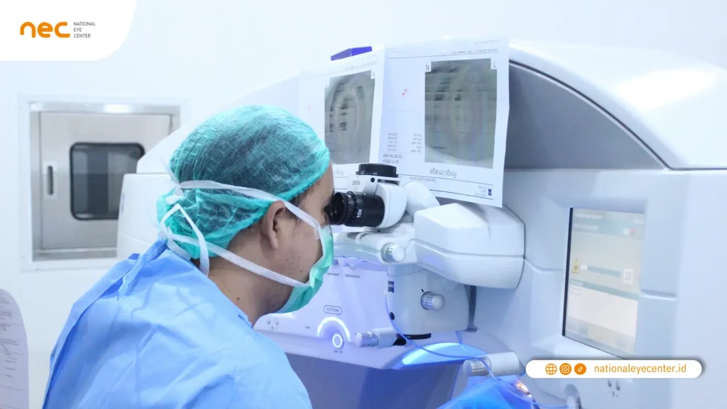 Pelaksanaan Operasi LASIK Pelaksanaan Operasi LASIK