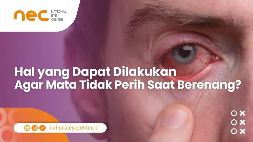 Hal yang dapat dilakukan supaya mata tidak perih saat berenang