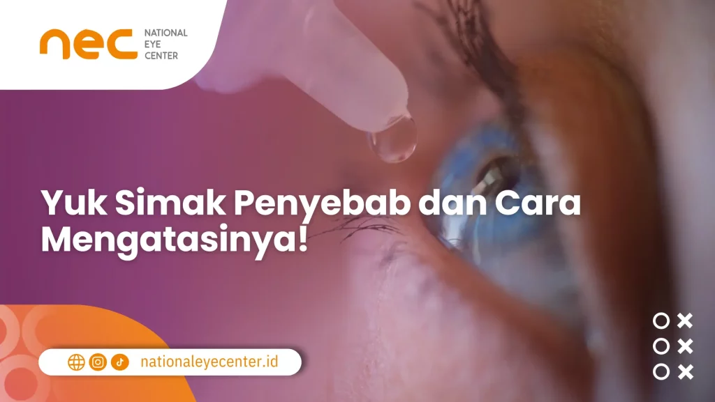Cara mengatasi mata perih setelah berenang