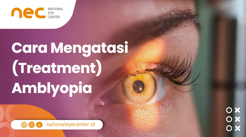Cara Mengatasi Ambliopia warna
