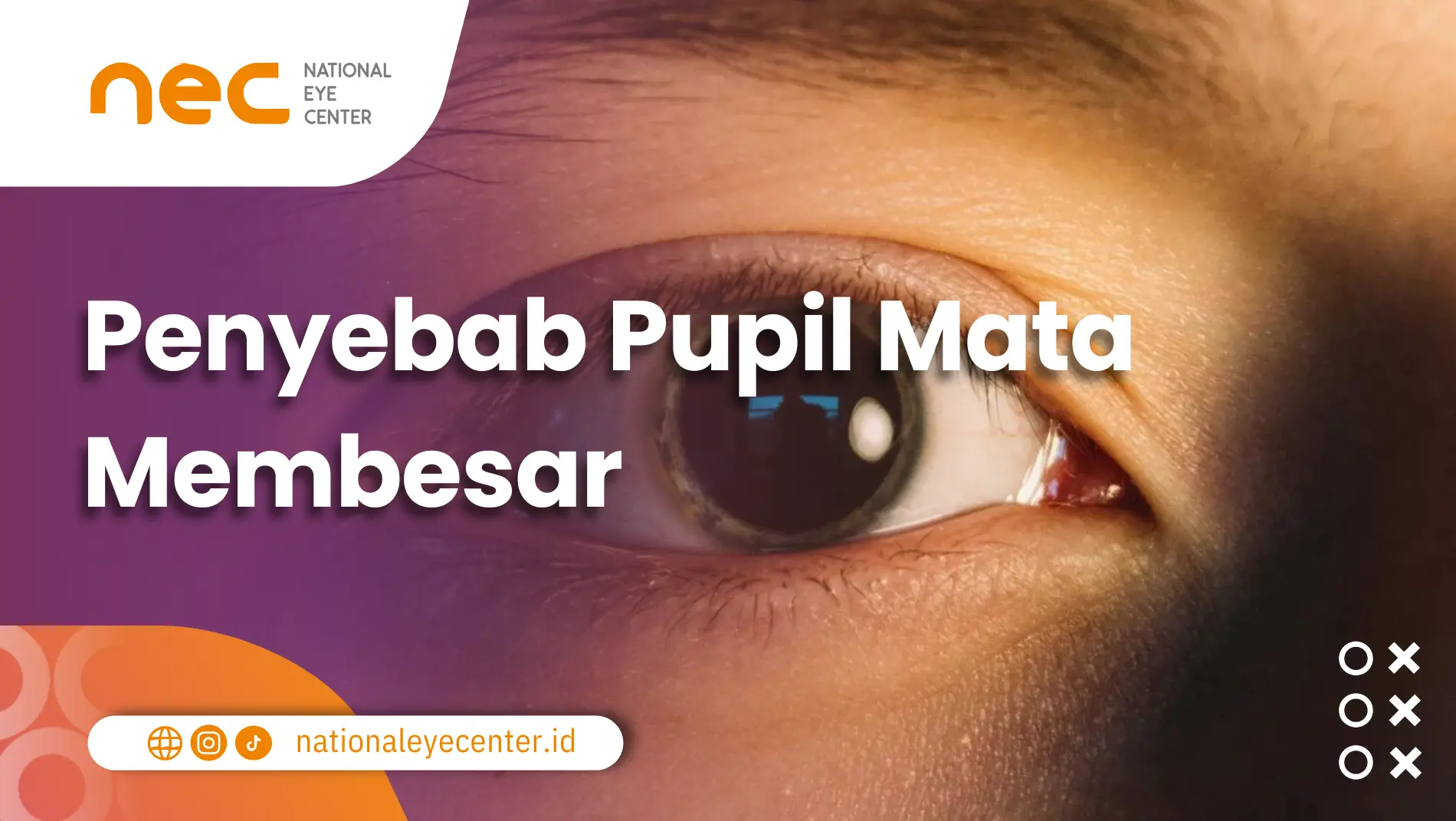 Penyebab Pupil Mata Membesar